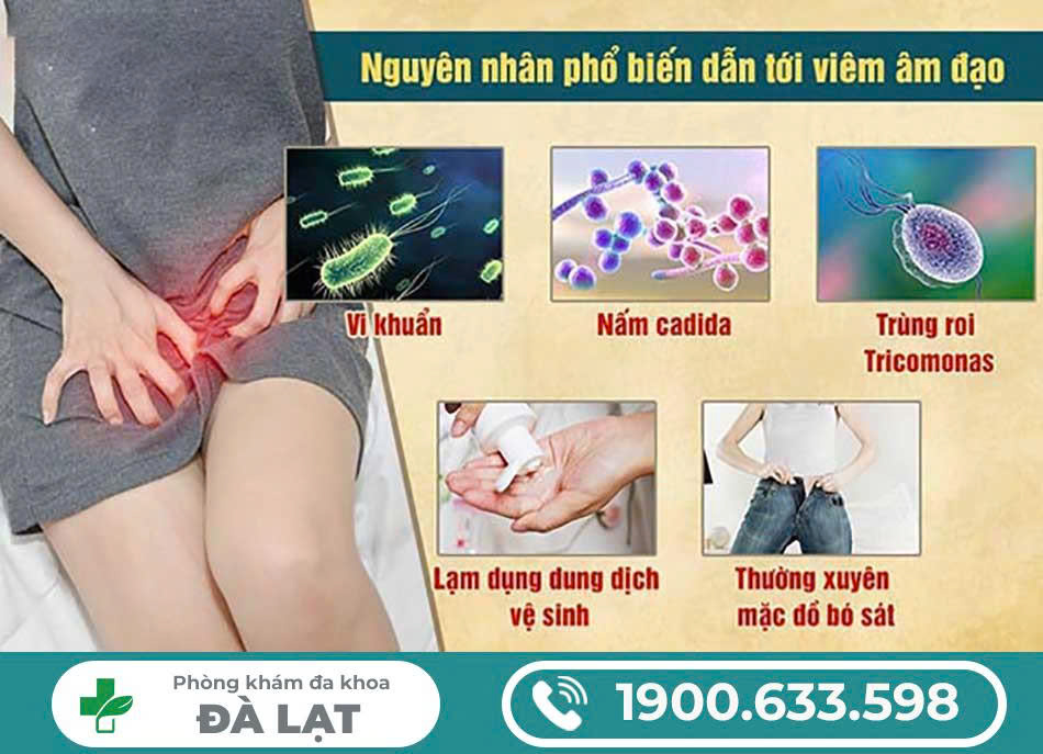 Hình ảnh minh họa